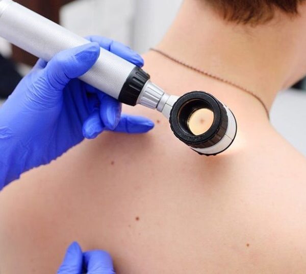 Дерматолог Киев: профессиональный подход к лечению кожи